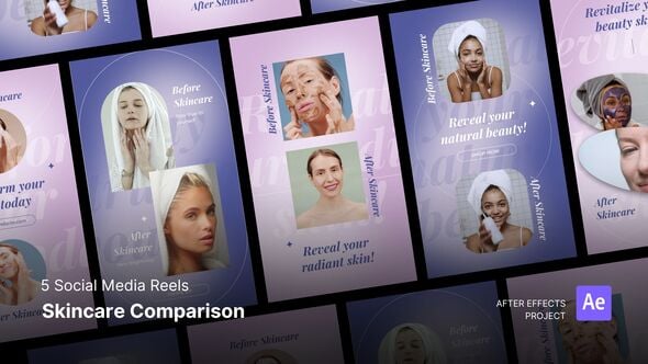 Videohive Social Media Reels – Skincare Result Comparison After Effects Project Files