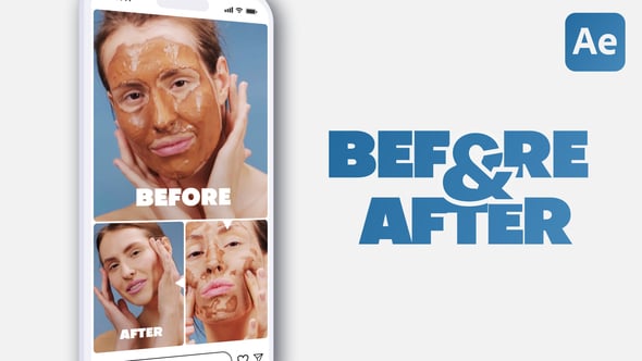 Videohive Vertical Clean Before and After