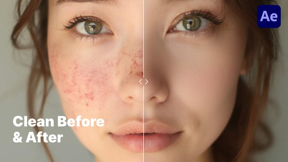 Videohive Minimalistic & Clean Before & After Comparison – Premiere Pro Template