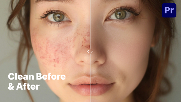 VideoHive Minimalistic & Clean Before & After Comparison – Premiere Pro (MOGRT)